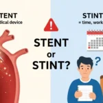 stent or stint